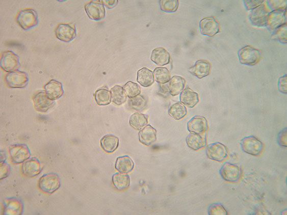 Entoloma rhodopolium fo. nidorosum