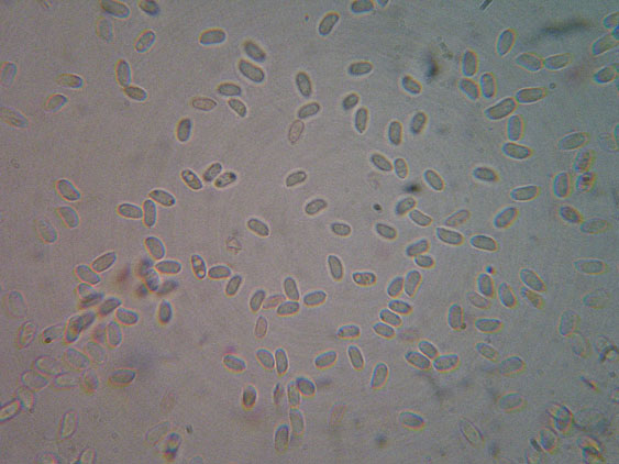 Phanerochaete raduloides? (Phanerochaete aculeata)