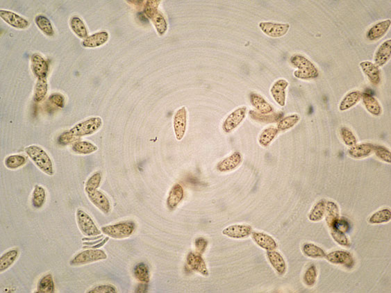 Botryobasidium da determinare