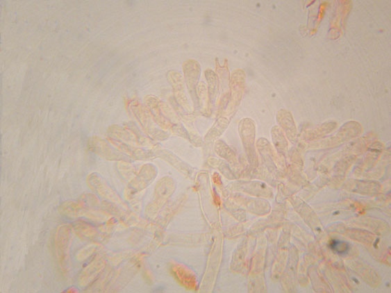 Da determinare (Athelia sp.)