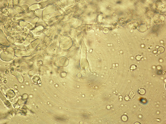 Due croste forse una su abete-foto0555(Hyphoderma setigerum)