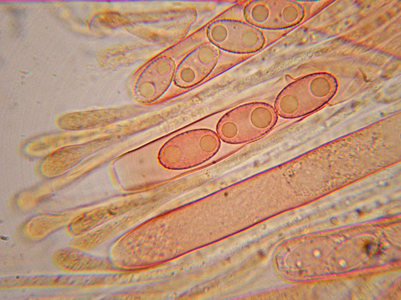 Peziza da determinare