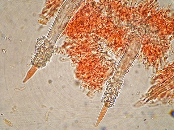 Tubulicrinis subulatus