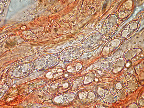 Pachyella lazzariana?