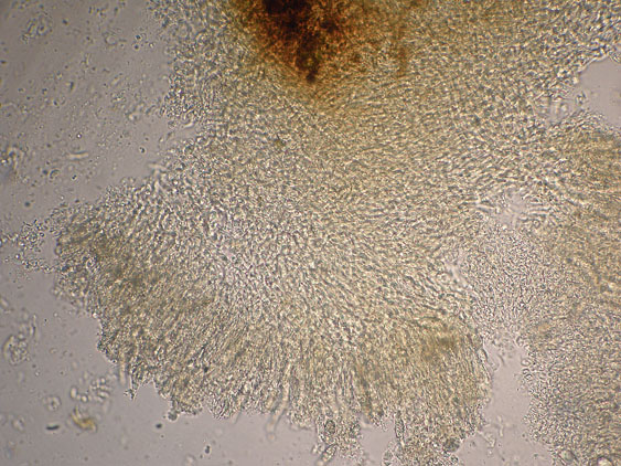 Quiz N.7 (Peniophora quercina)