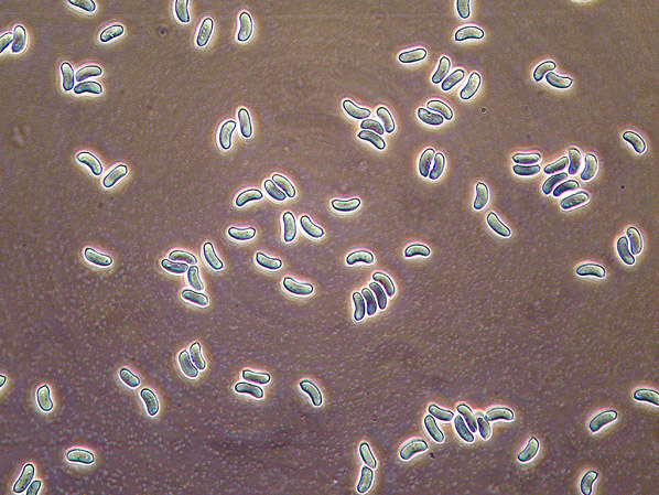 Quiz N.7 (Peniophora quercina)