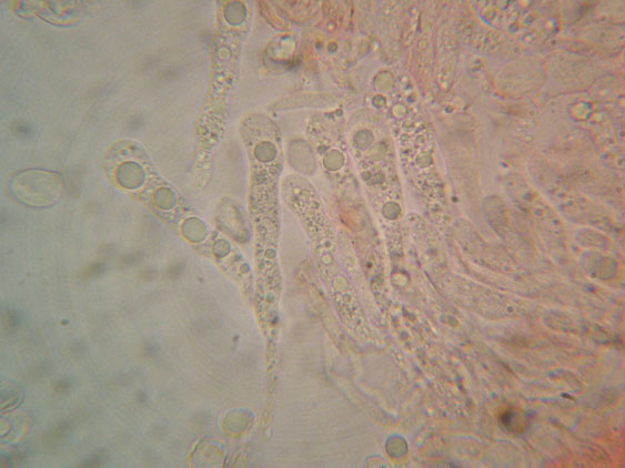 Radulomyces confluens