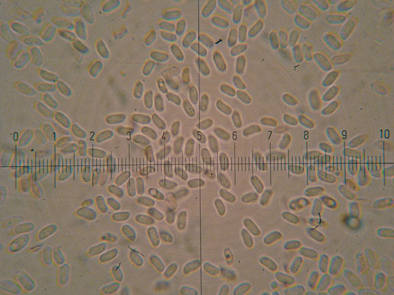 Phanerochaete raduloides? (Phanerochaete aculeata)