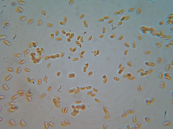 Intrusi tra gli  Aphyllophorales