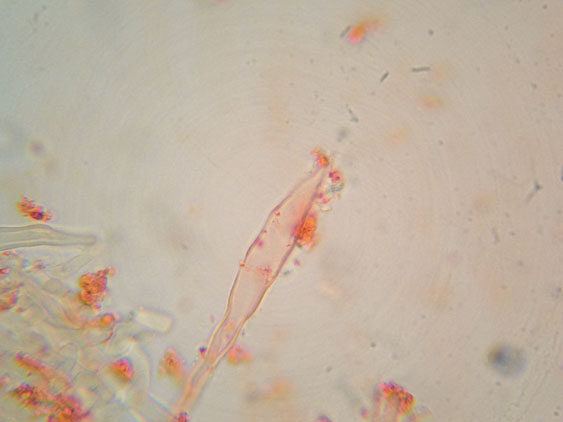 Intrusi tra gli  Aphyllophorales