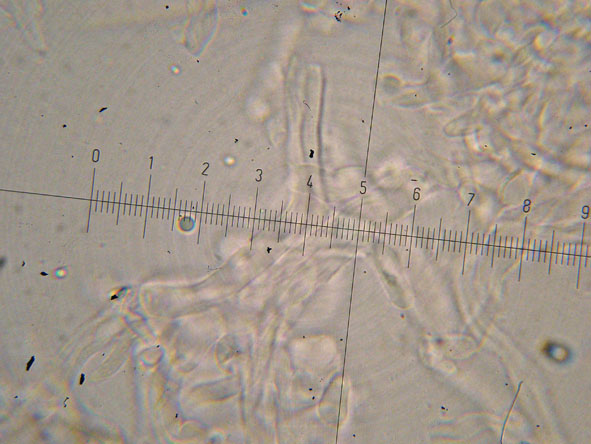 Obducta o floriformis? (Osteina obducta)