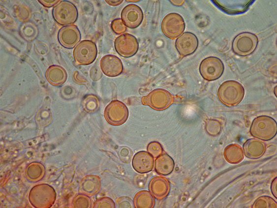 Aphyllophorales con clamidospore(Granulobasidium vellereum)