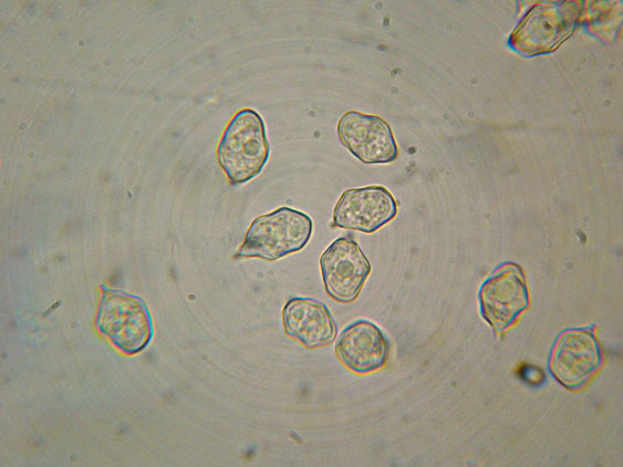 Raccolte del 30 e  31 Maggio