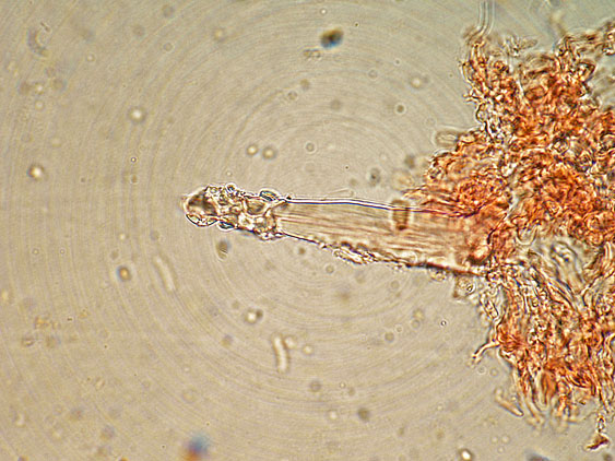 Tubulicrinis subulatus