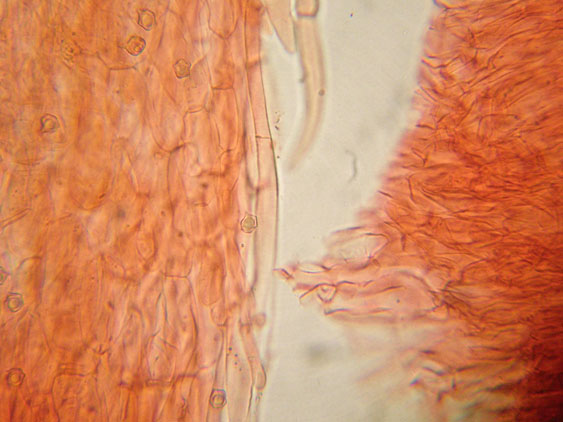 Entoloma rhodopolium fo. nidorosum