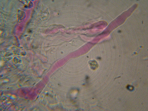 Hyphoderma roseocremeum? (Hyphoderma roseocremeum)