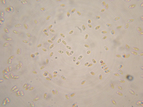 Da determinare (Ceraceomyces serpens)