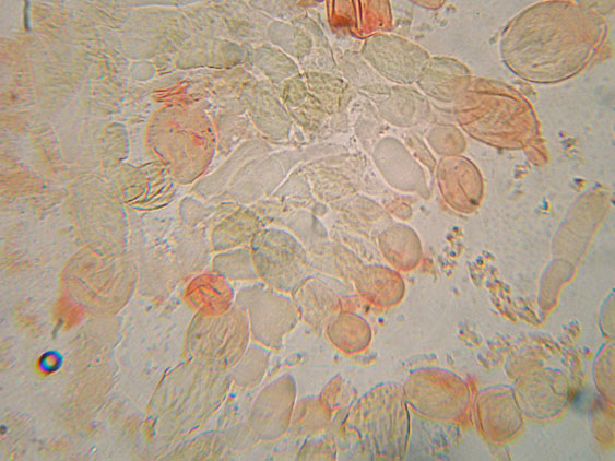 Xerocomus cisalpinus?