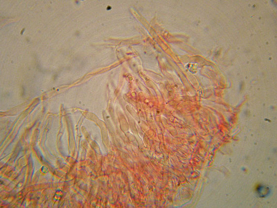 Basidioradulum crustosum