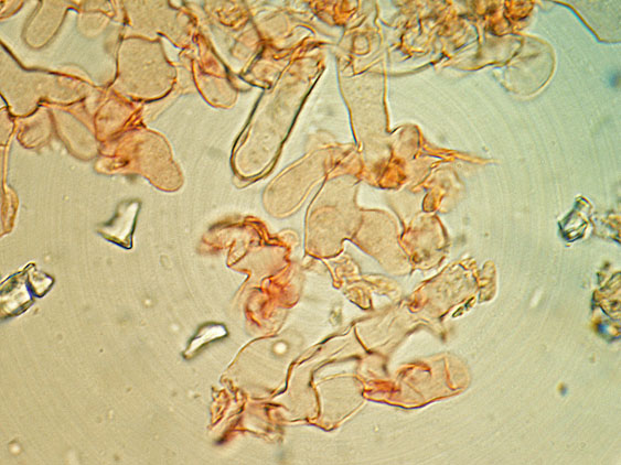 Botryobasidium subcoronatum