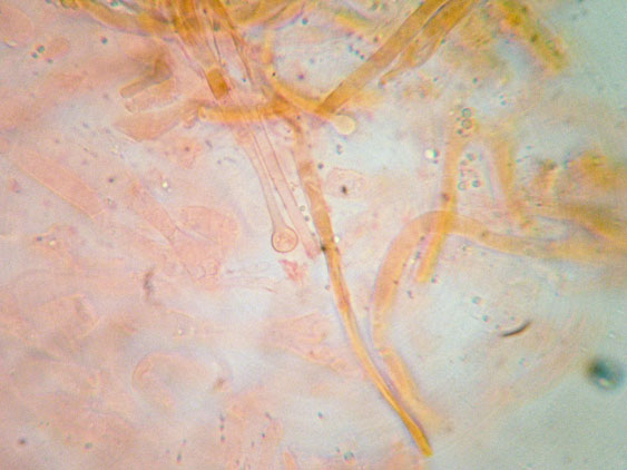 Raccolte del 9 Novembre