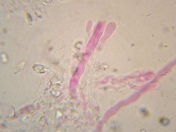 Hyphoderma roseocremeum? (Hyphoderma roseocremeum)