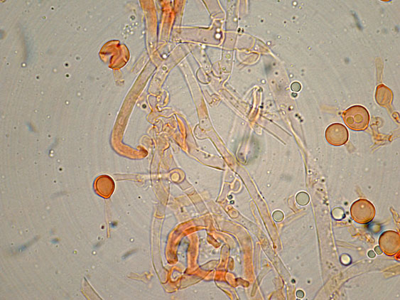 Aphyllophorales con clamidospore(Granulobasidium vellereum)
