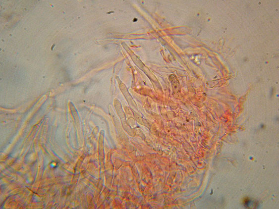 Basidioradulum crustosum