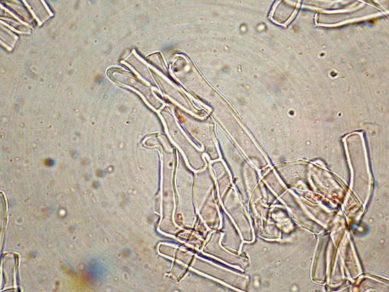 Phanerochaete con Gaf?