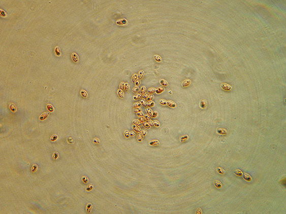 Quiz N.4 (Phaeolus schweinitzii)