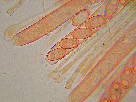 Peziza da determinare