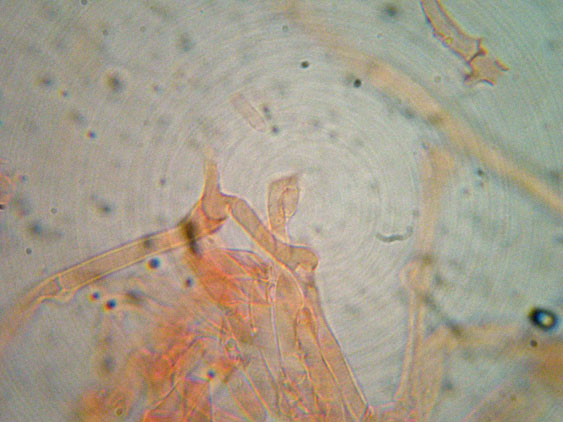 Clitocybe phyllophila