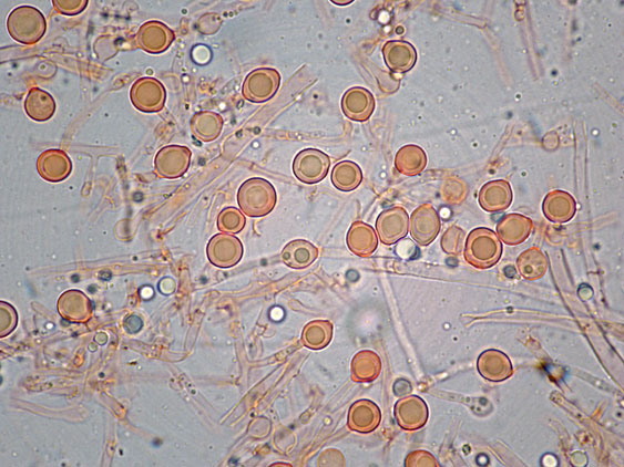 Aphyllophorales con clamidospore(Granulobasidium vellereum)