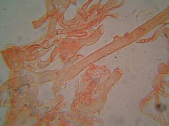 Crosticina con rizomorfe (Phanerochaete velutina)