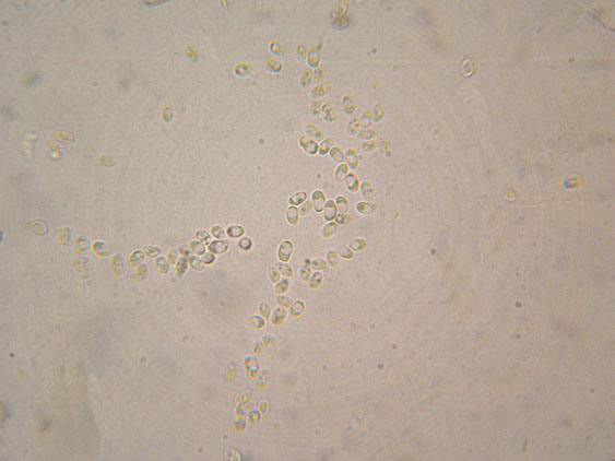 Crosticina senza rizomorfe (Trechispora confinis)