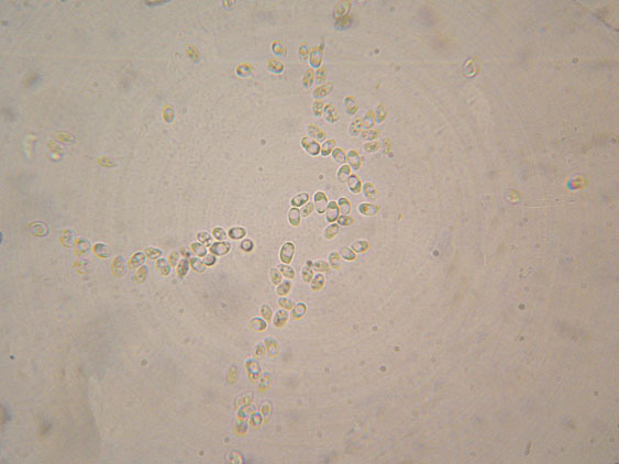 Crosticina senza rizomorfe (Trechispora confinis)