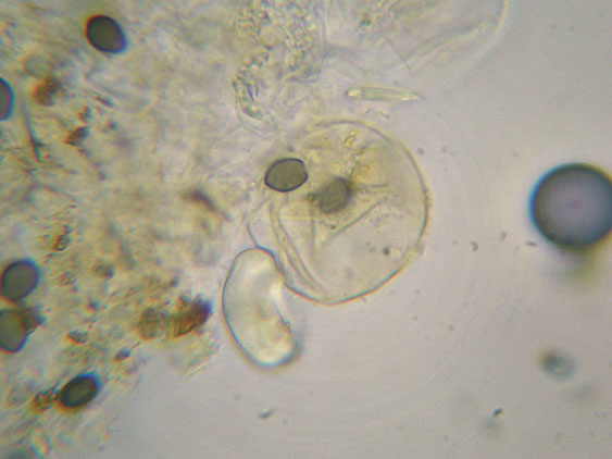 Raccolte del 30 e  31 Maggio