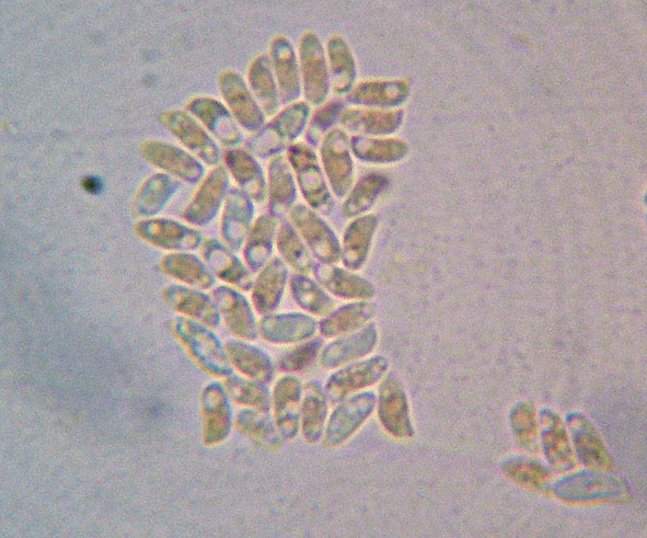 Obducta o floriformis? (Osteina obducta)