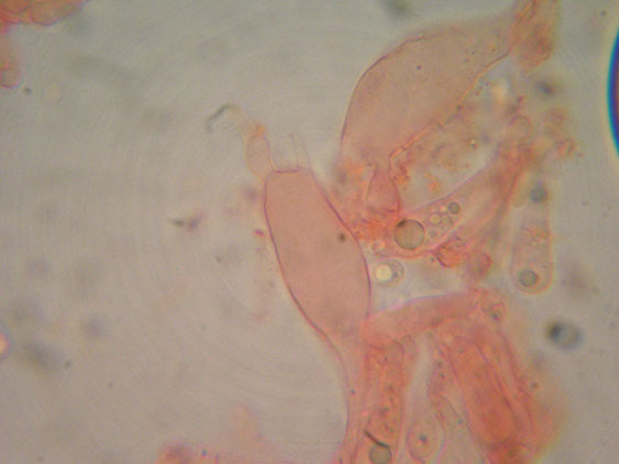 Raccolte del 9 Novembre