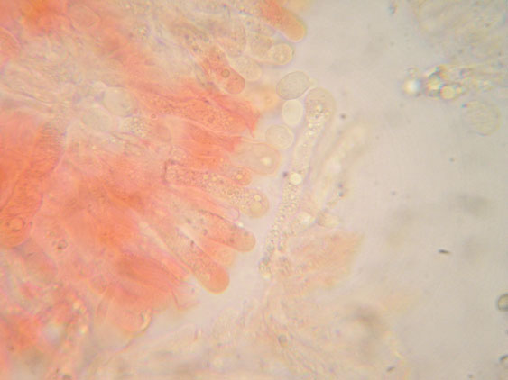 Radulomyces confluens