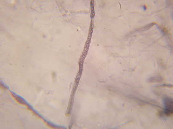 Gloiothele lactescens? (Gloiothele lactescens)