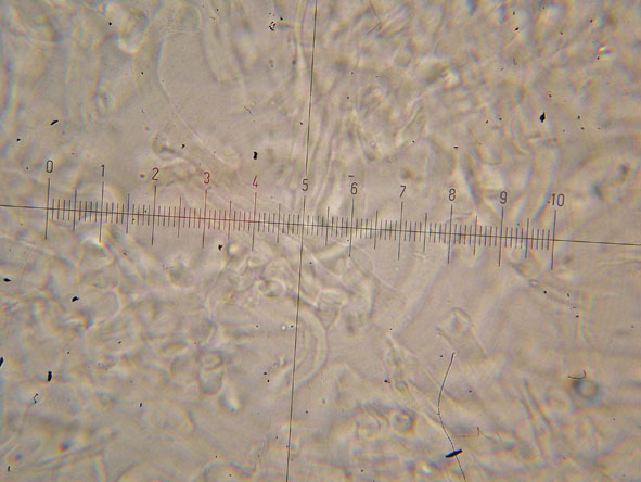 Obducta o floriformis? (Osteina obducta)