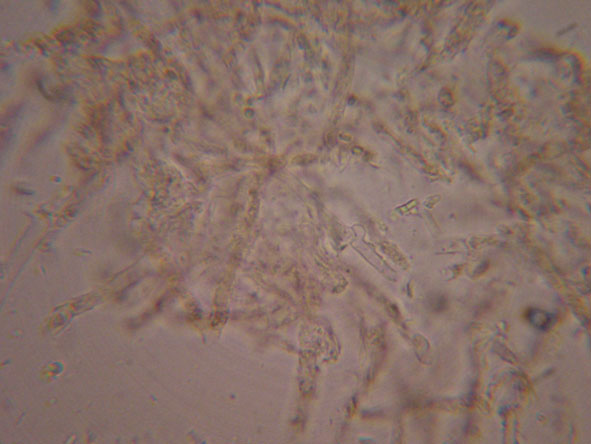 Skeletocutis nivea? (Skeletocutis nivea)