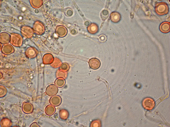 Aphyllophorales con clamidospore(Granulobasidium vellereum)