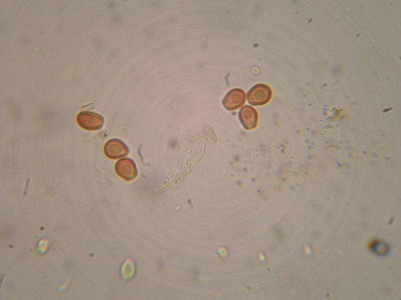 Altro lignicolo dalla Riserva Vomano (Perenniporia sp.)