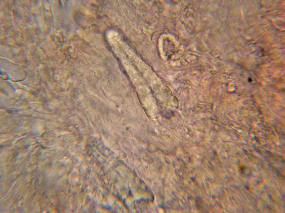 Mutatoderma mutatum