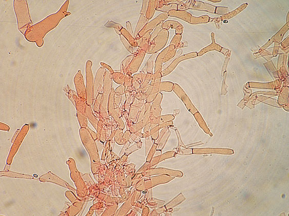 Melanoleuca da determinare
