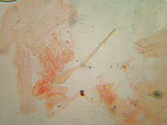 Raccolte del 30 e  31 Maggio