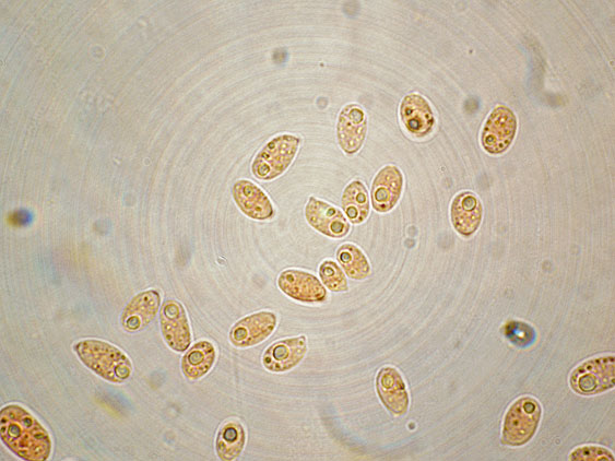 Quiz N.4 (Phaeolus schweinitzii)