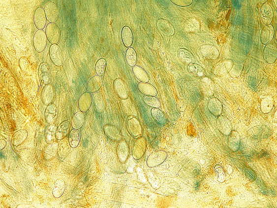 Pachyella lazzariana?